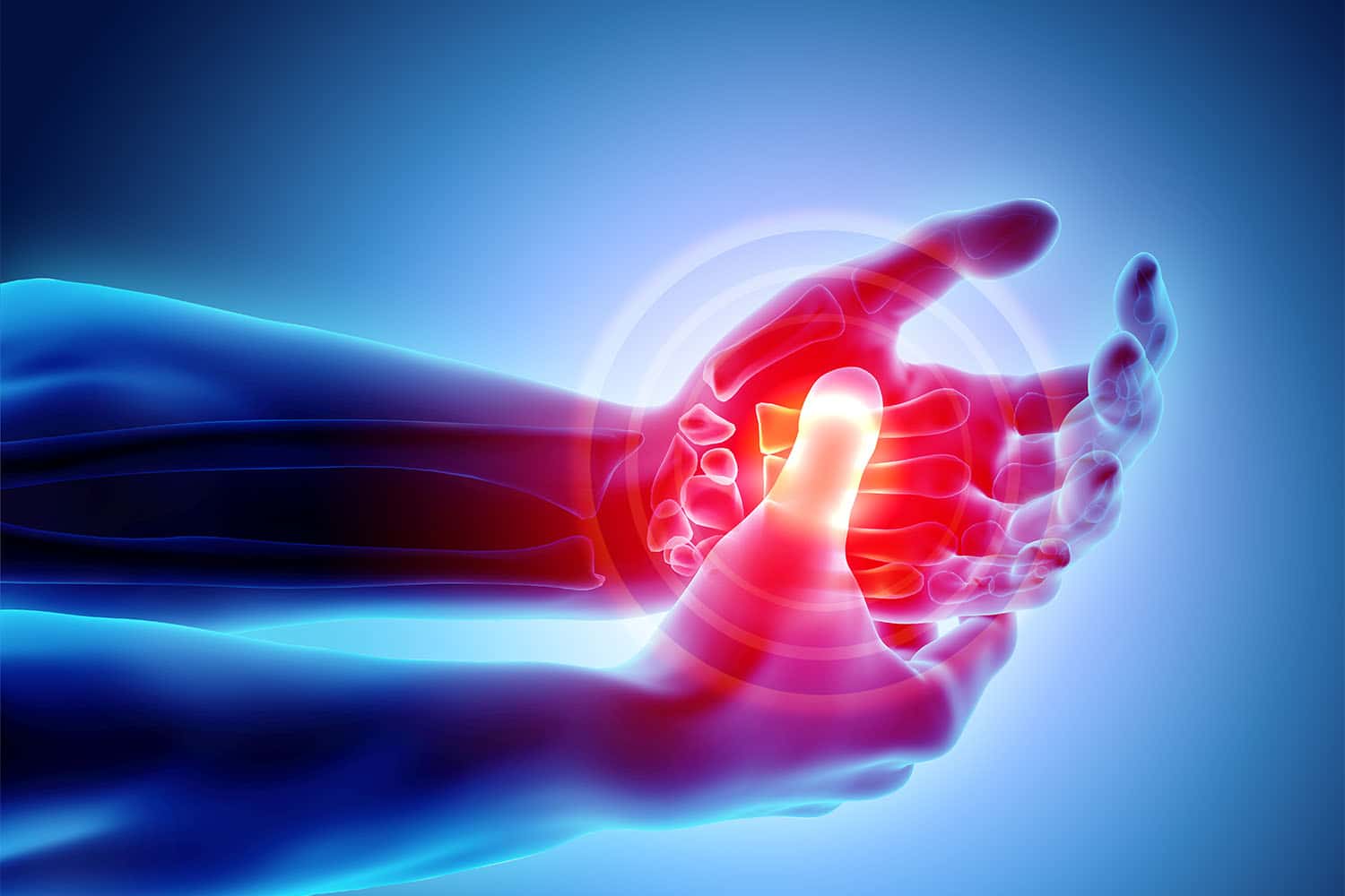 How To Prevent Arthritis in Hands