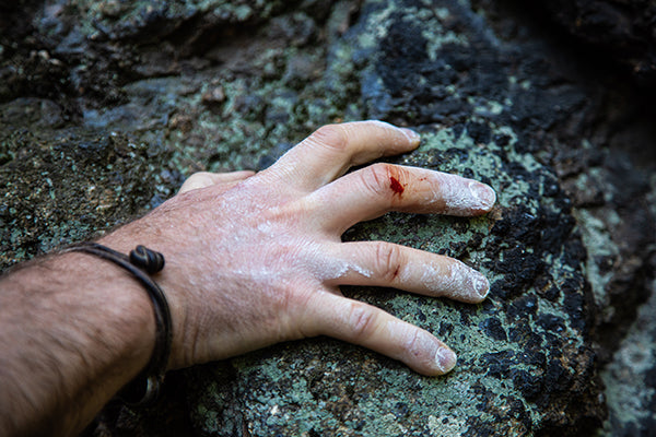 Accelerating Recovery: How CBD Can Aid Climbers in Overcoming Finger Injuries