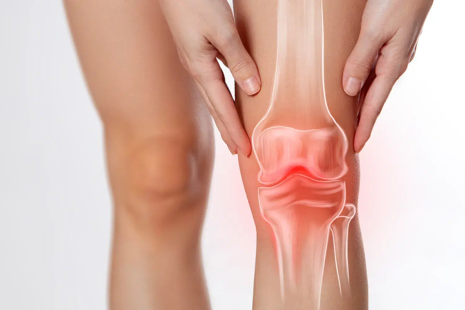 Sciatica Knee Pain: Causes and Relief Options